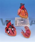 Classic Heart Anatomy with Bypass, 2 part model